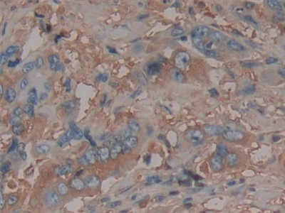 Antithrombin Antibody in Immunohistochemistry (Paraffin) (IHC (P))