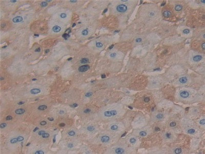 Antithrombin Antibody in Immunohistochemistry (Paraffin) (IHC (P))