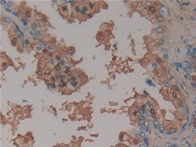 Antithrombin Antibody in Immunohistochemistry (Paraffin) (IHC (P))