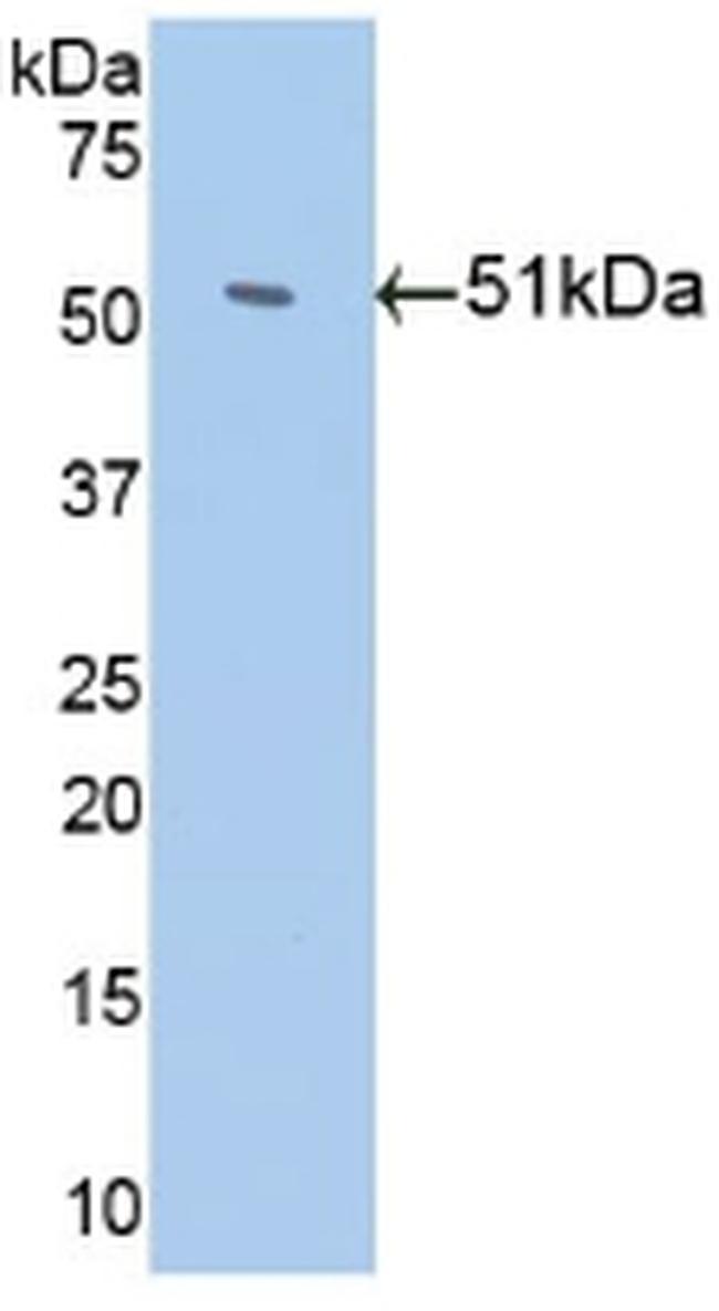 Antithrombin Antibody in Western Blot (WB)