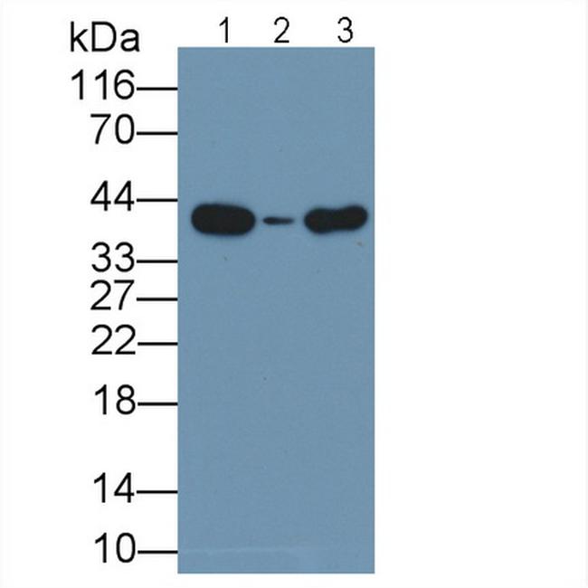 Arginase 2 Antibody in Western Blot (WB)