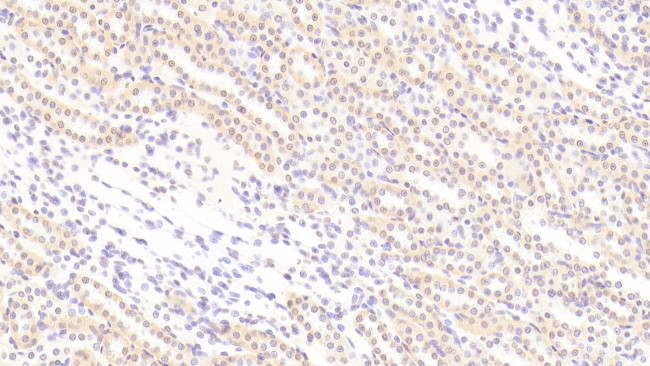 BMP3 Antibody in Immunohistochemistry (Paraffin) (IHC (P))