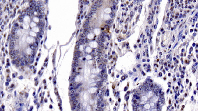 Caspase 6 Antibody in Immunohistochemistry (Paraffin) (IHC (P))