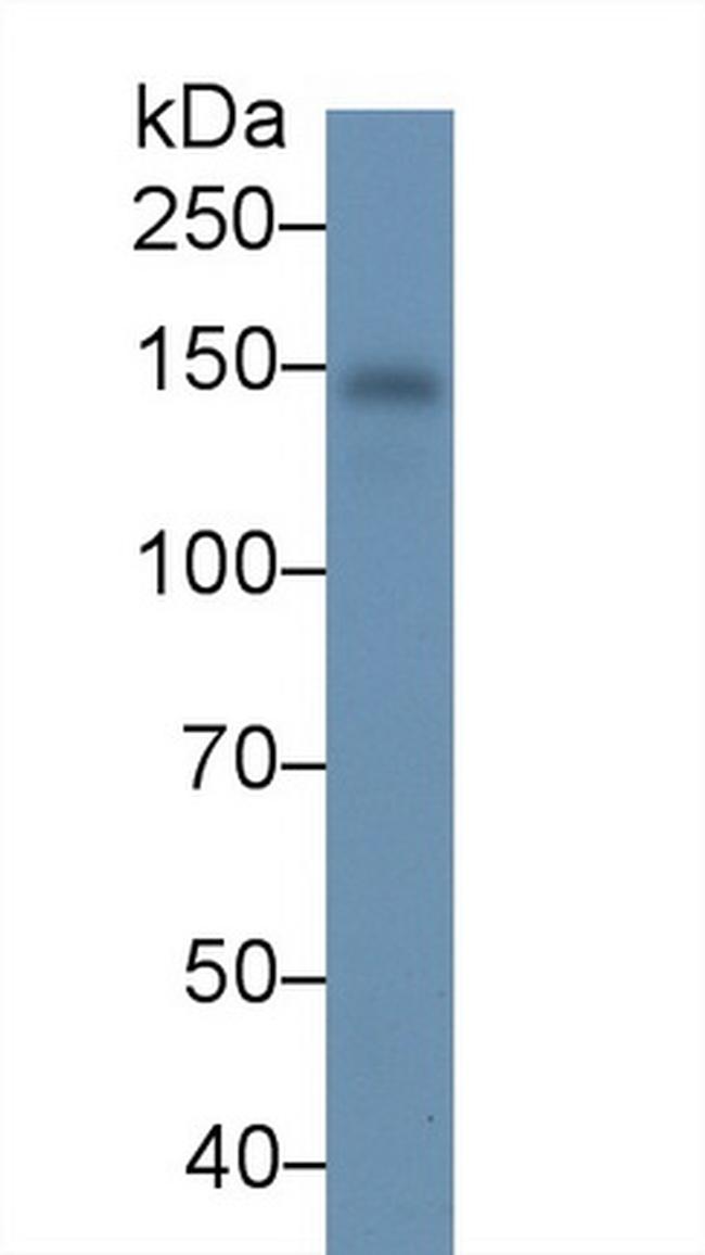 Ceruloplasmin Antibody in Western Blot (WB)