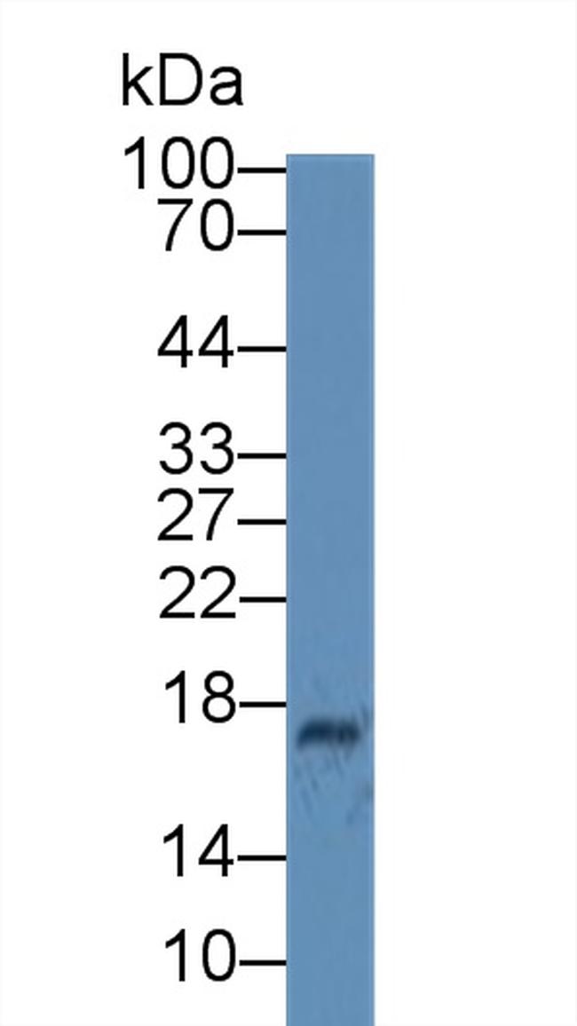 Ceruloplasmin Antibody in Western Blot (WB)