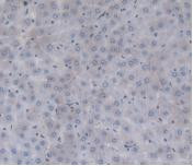 Prothrombin Antibody in Immunohistochemistry (Paraffin) (IHC (P))