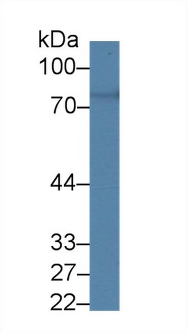 Prothrombin Antibody in Western Blot (WB)