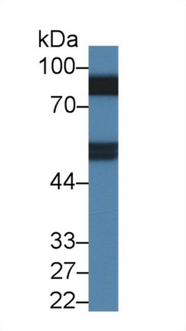 Prothrombin Antibody in Western Blot (WB)