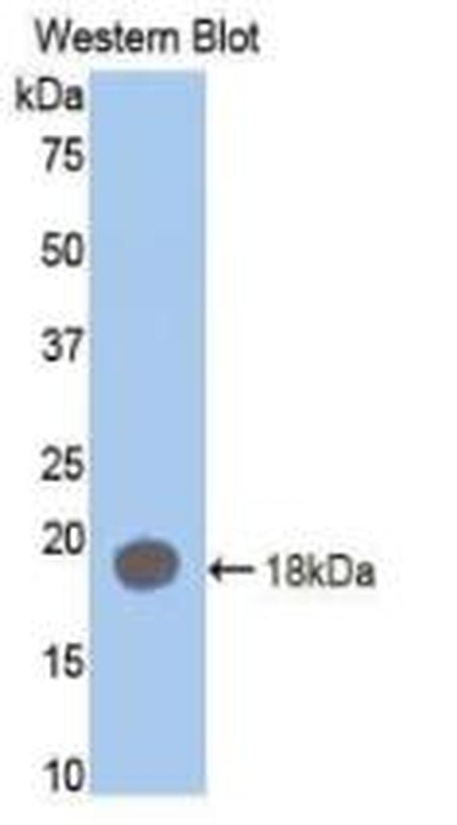 Prothrombin Antibody in Western Blot (WB)