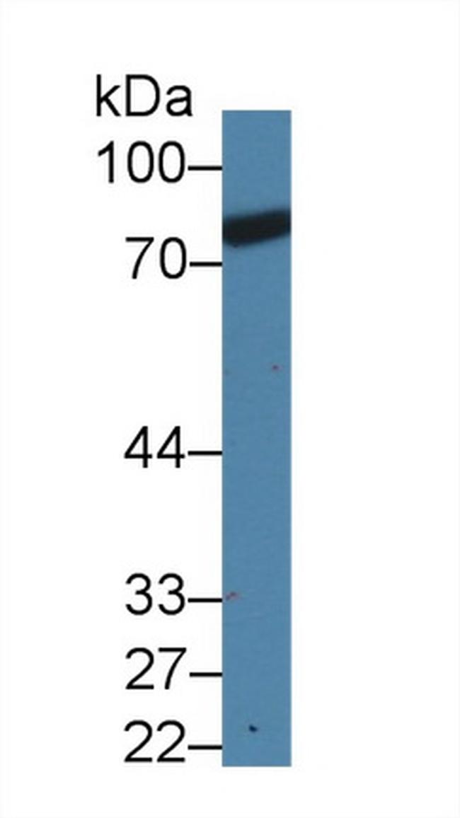 Prothrombin Antibody in Western Blot (WB)