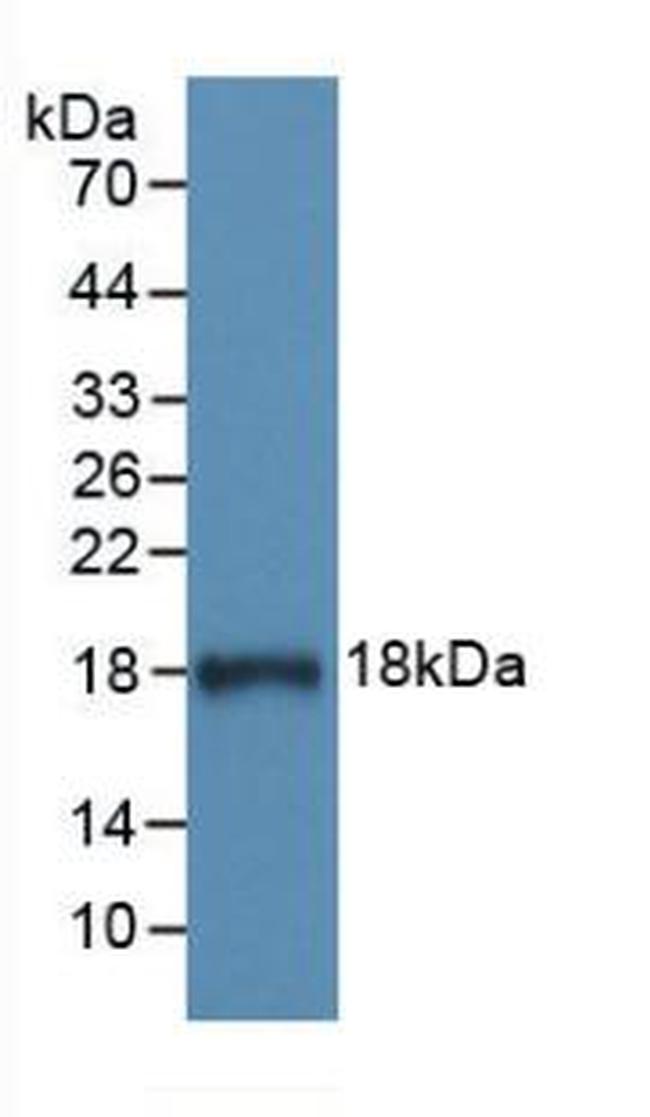 C1 inhibitor Antibody in Western Blot (WB)