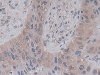 Cyclophilin A Antibody in Immunohistochemistry (Paraffin) (IHC (P))