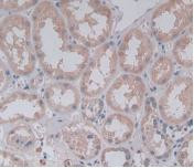 PLA2G4A Antibody in Immunohistochemistry (Paraffin) (IHC (P))