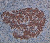 PLA2G4A Antibody in Immunohistochemistry (Paraffin) (IHC (P))