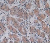 PLA2G4A Antibody in Immunohistochemistry (Paraffin) (IHC (P))