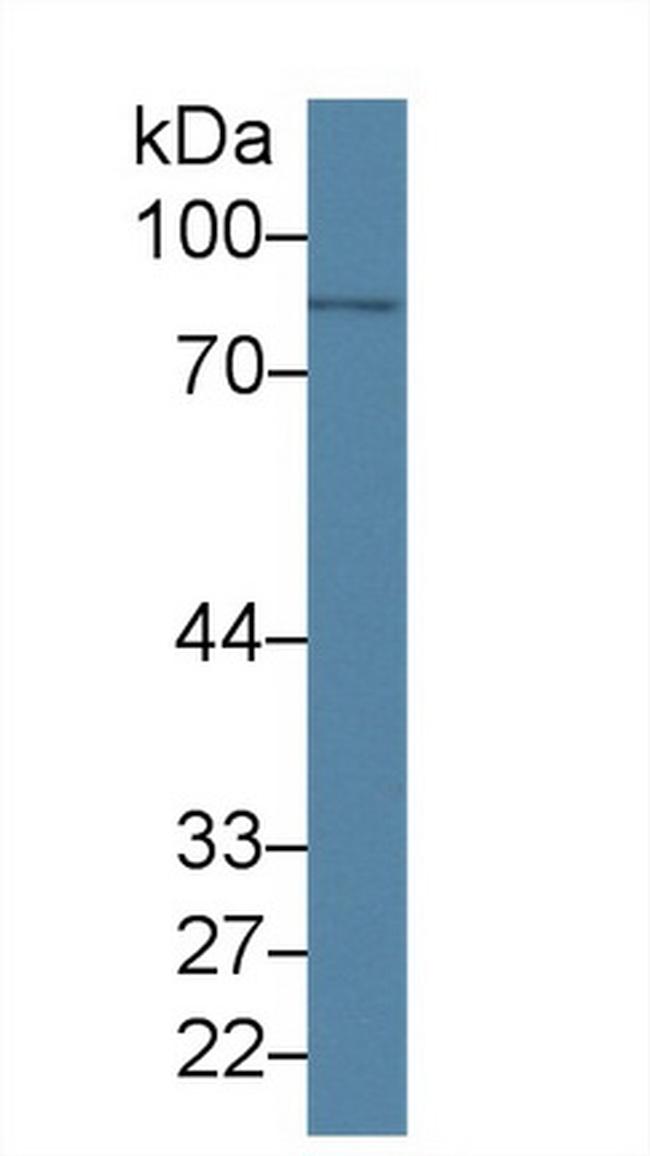 PLA2G4A Antibody in Western Blot (WB)