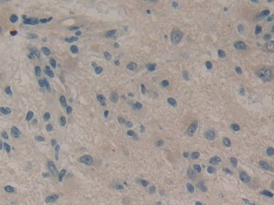 DKK1 Antibody in Immunohistochemistry (Paraffin) (IHC (P))