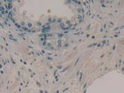 DKK1 Antibody in Immunohistochemistry (Paraffin) (IHC (P))