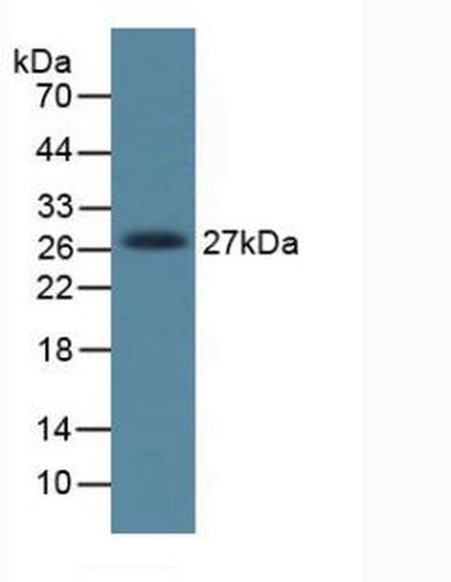 DKK1 Antibody in Western Blot (WB)