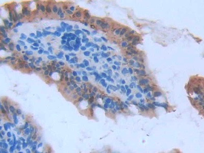 FABP2 Antibody in Immunohistochemistry (Paraffin) (IHC (P))