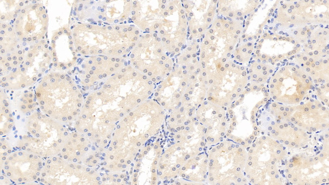 Fibrinogen Beta Chain Antibody in Immunohistochemistry (Paraffin) (IHC (P))