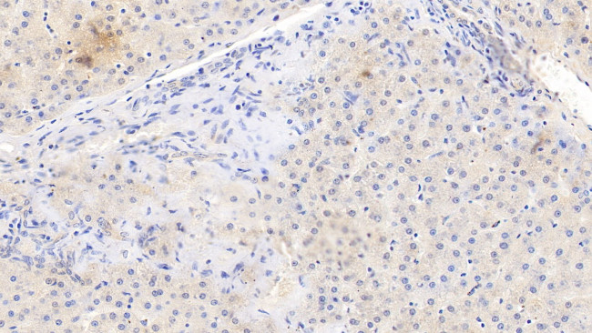 Fibrinogen Beta Chain Antibody in Immunohistochemistry (Paraffin) (IHC (P))