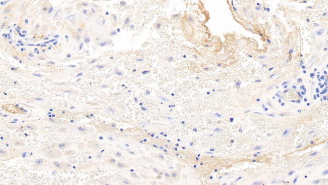 Fibrinogen Beta Chain Antibody in Immunohistochemistry (Paraffin) (IHC (P))