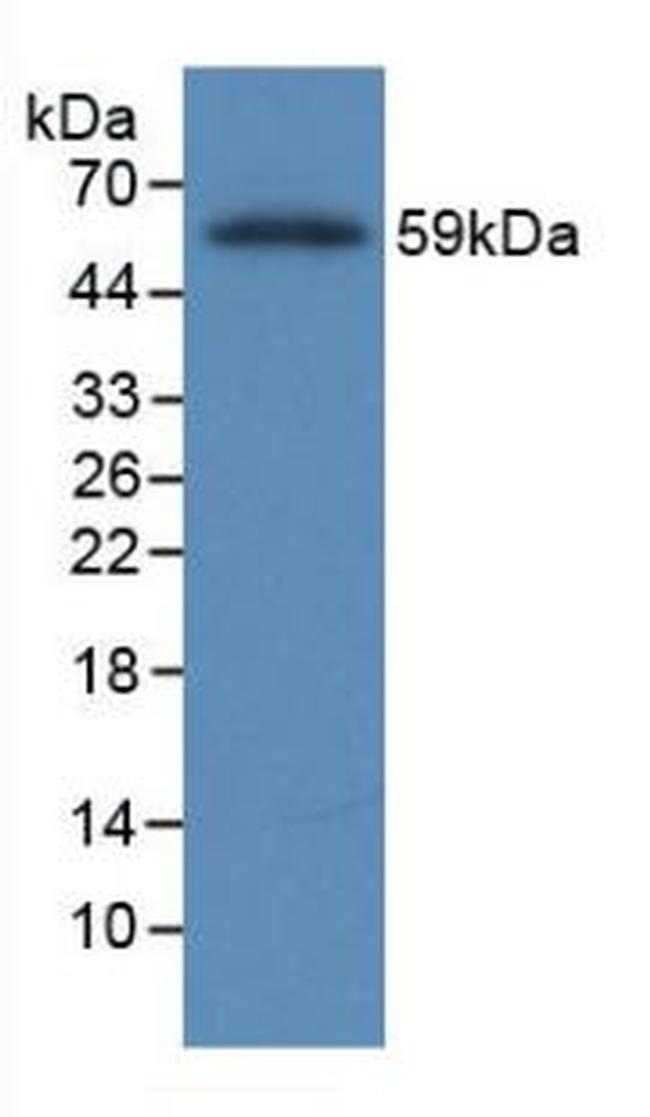 Fibrinogen Beta Chain Antibody in Western Blot (WB)