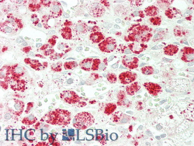 alpha Galactosidase Antibody in Immunohistochemistry (Paraffin) (IHC (P))