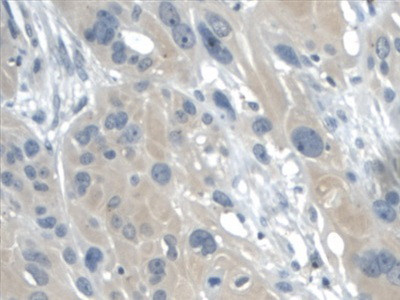 Galectin 2 Antibody in Immunohistochemistry (Paraffin) (IHC (P))