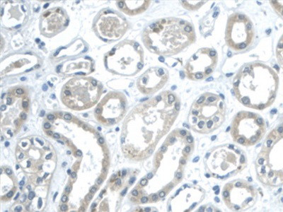 Galectin 2 Antibody in Immunohistochemistry (Paraffin) (IHC (P))