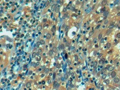 HSPA1L Antibody in Immunohistochemistry (Paraffin) (IHC (P))