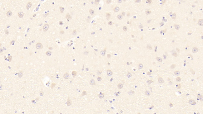 HSPA1B Antibody in Immunohistochemistry (Paraffin) (IHC (P))