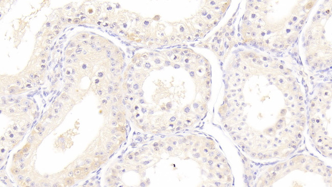 HSPA1B Antibody in Immunohistochemistry (Paraffin) (IHC (P))