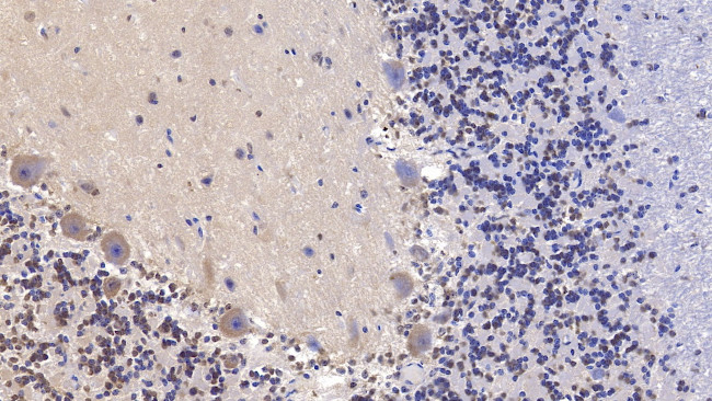 SHH Antibody in Immunohistochemistry (Paraffin) (IHC (P))