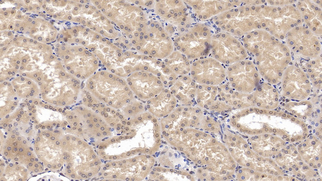 SHH Antibody in Immunohistochemistry (Paraffin) (IHC (P))