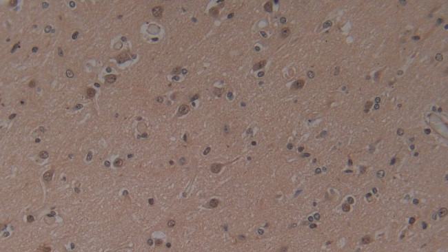 HFE2 Antibody in Immunohistochemistry (Paraffin) (IHC (P))