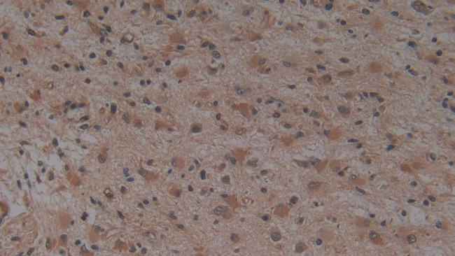 HFE2 Antibody in Immunohistochemistry (Paraffin) (IHC (P))