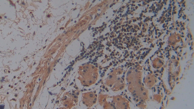 HFE2 Antibody in Immunohistochemistry (Paraffin) (IHC (P))