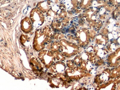 IGFBP-1 Antibody in Immunohistochemistry (Paraffin) (IHC (P))