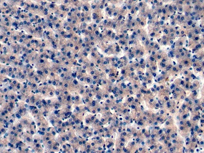 IGFBP4 Antibody in Immunohistochemistry (Paraffin) (IHC (P))