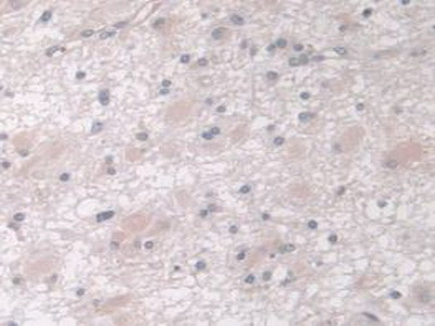 IGFBP4 Antibody in Immunohistochemistry (Paraffin) (IHC (P))