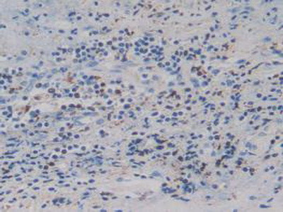 IGFBP4 Antibody in Immunohistochemistry (Paraffin) (IHC (P))