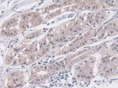 IGFBP4 Antibody in Immunohistochemistry (Paraffin) (IHC (P))