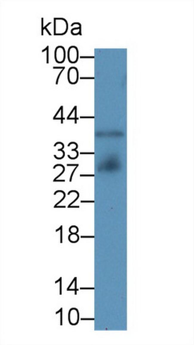 IGFBP4 Antibody in Western Blot (WB)