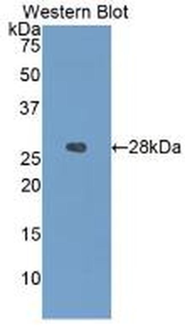 IGFBP4 Antibody in Western Blot (WB)