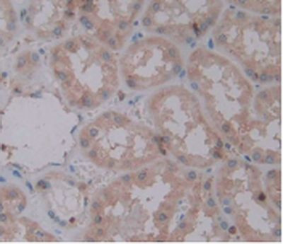 IL-1 alpha Antibody in Immunohistochemistry (Paraffin) (IHC (P))