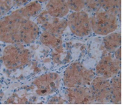 IL-1 alpha Antibody in Immunohistochemistry (Paraffin) (IHC (P))