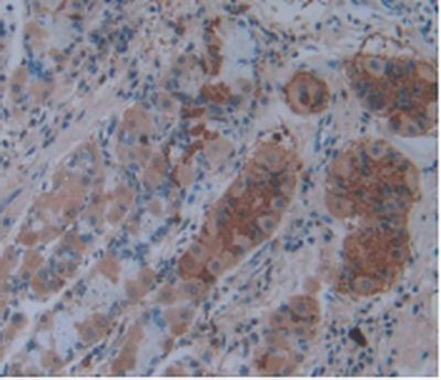 IL-1 alpha Antibody in Immunohistochemistry (Paraffin) (IHC (P))