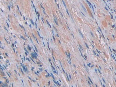 IL-1 alpha Antibody in Immunohistochemistry (Paraffin) (IHC (P))